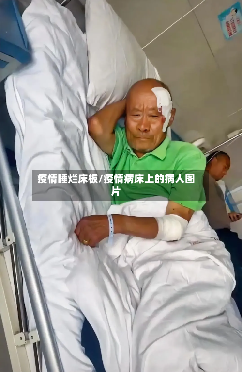 疫情睡烂床板/疫情病床上的病人图片