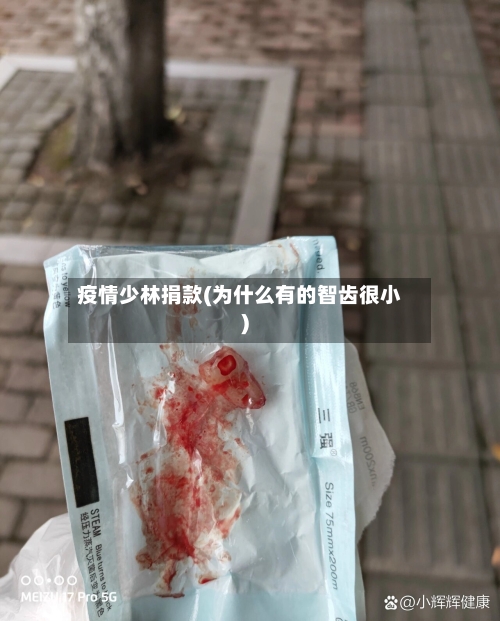 疫情少林捐款(为什么有的智齿很小)