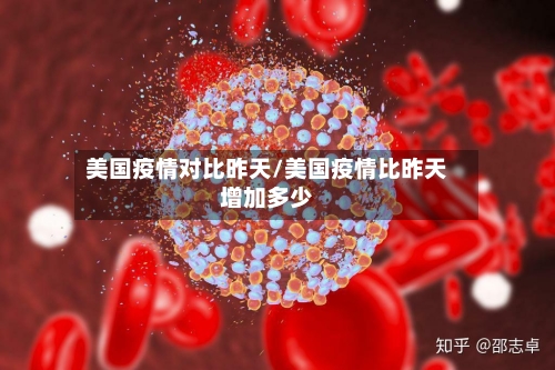 美国疫情对比昨天/美国疫情比昨天增加多少