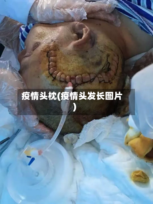 疫情头枕(疫情头发长图片)